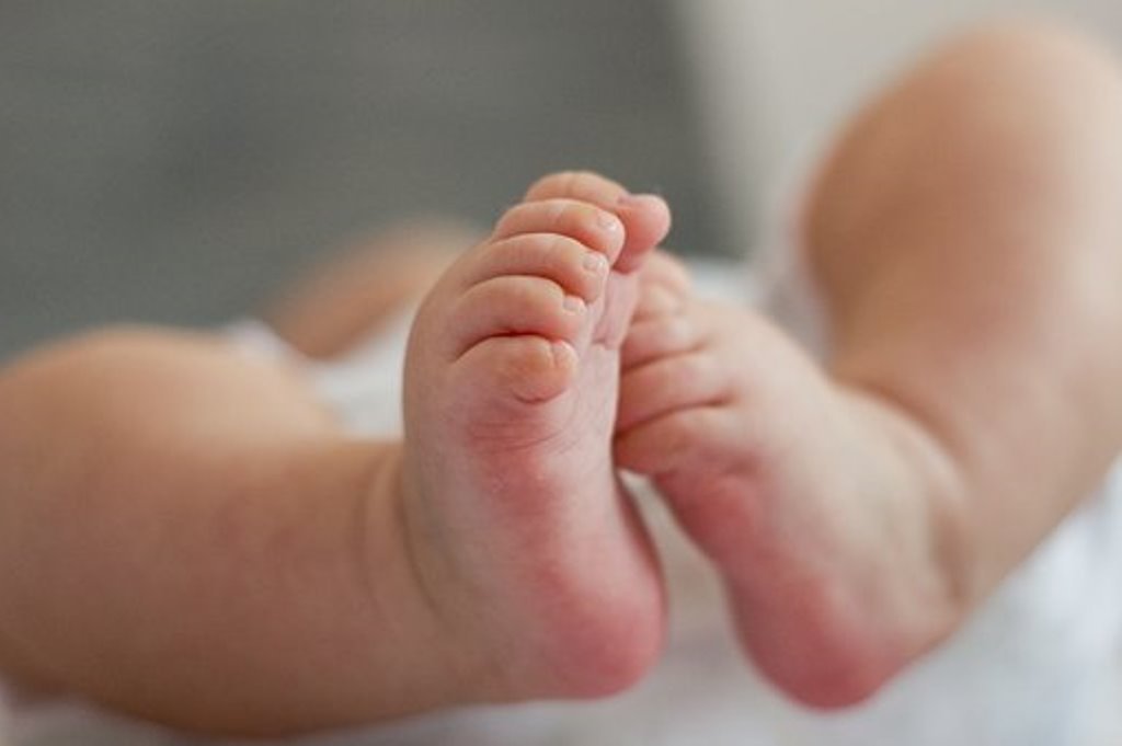 El caso de la bebé "embarazada" de su hermana gemela: Cómo pudo ocurrir.