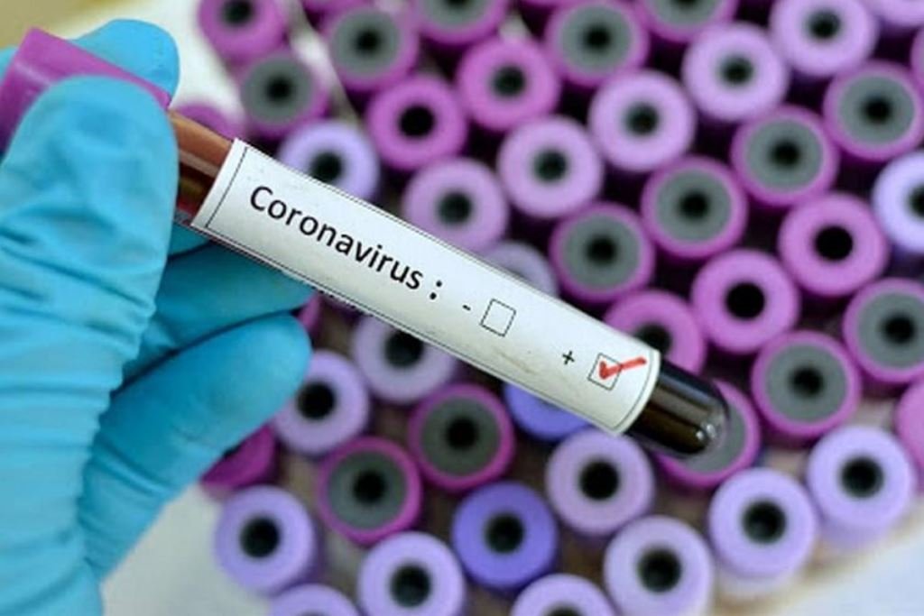 Coronavirus en Argentina: Récord absoluto  de  10.550 casos
