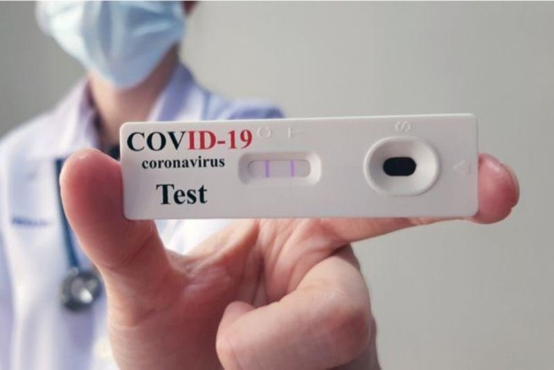 Los autotest de Covid-19 estarán disponibles en las farmacias en 15 días